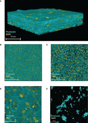 An immunoresponsive three-dimensional urine-tolerant human urothelial model to study urinary tract infection